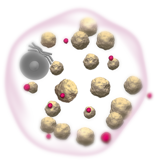 Gaucher Cell showing VPRIV action